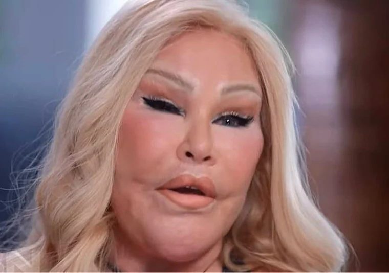 Jocelyn Wildenstein – metryka [wiek, wzrost, mąż i dzieci, pochodzenie, rodzina, życiorys]